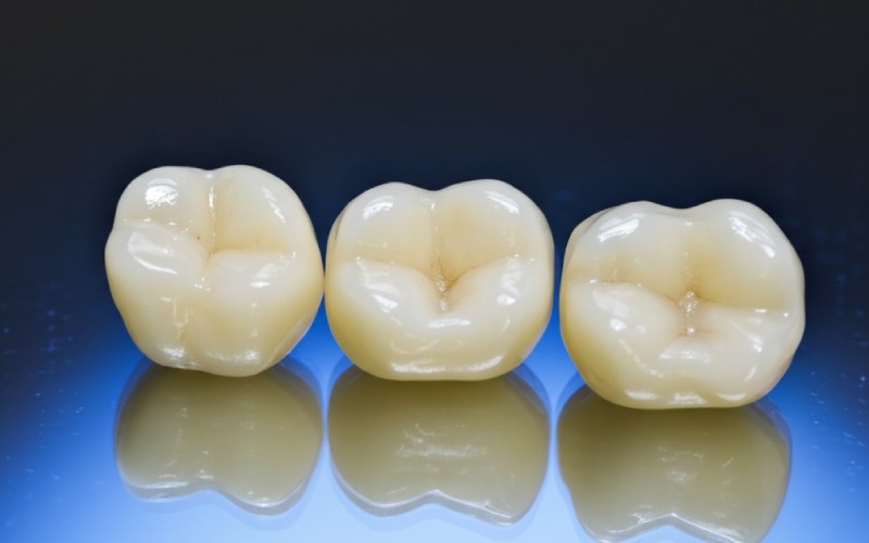 dental crowns in professional lighting
