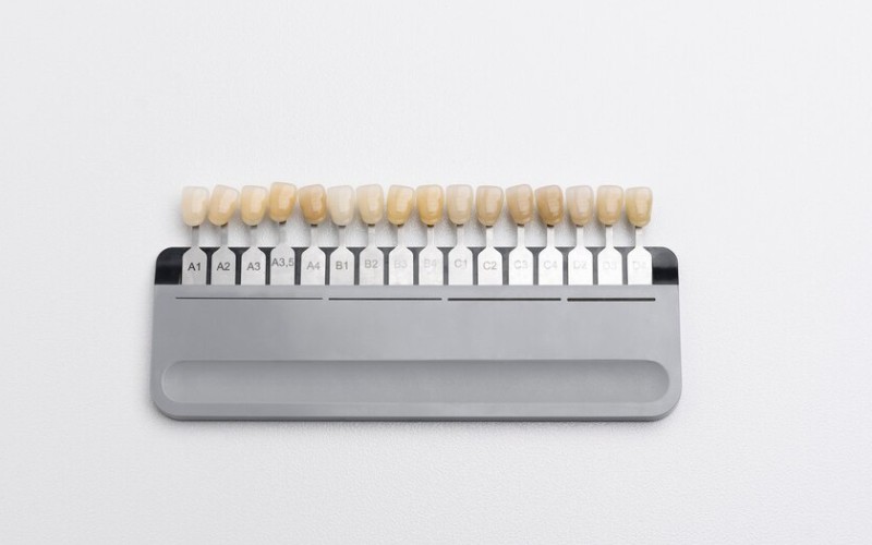 Dental composites arranged by VITA shade spectrum