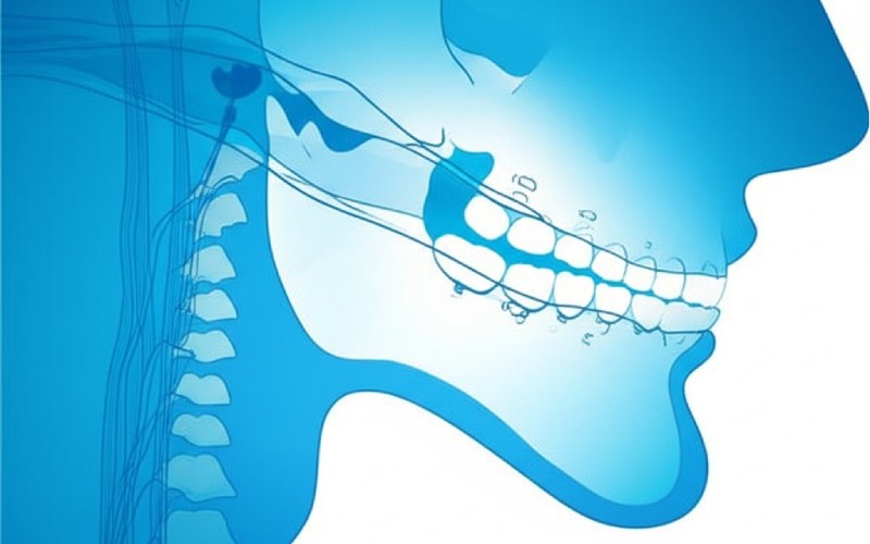 open airway with oral appliance