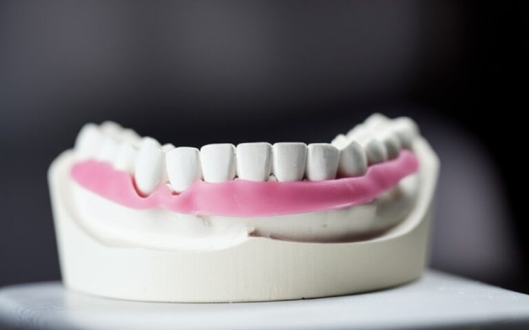 A precise dental wax rim on a plaster cast