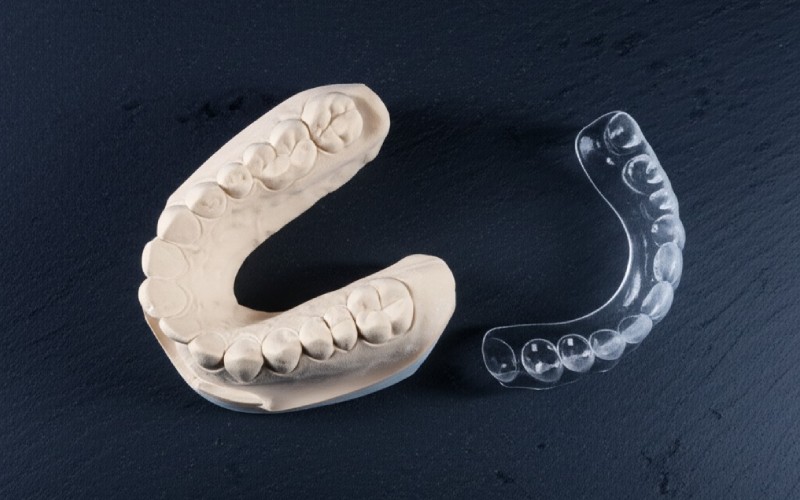 Custom bite splint on dental model