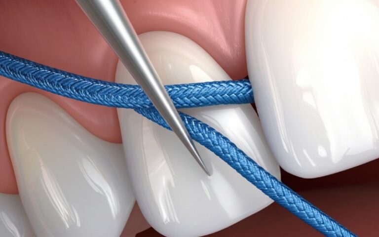 Dentiste insérant un cordon de rétraction