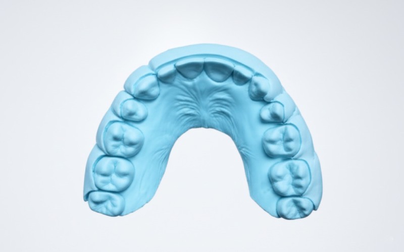 Denture with impression material showing a custom fit
