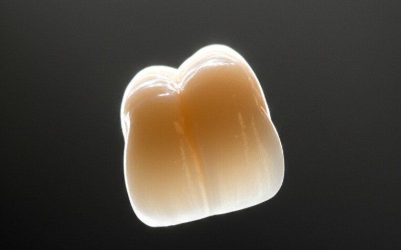 Translucent ceramic dental crown