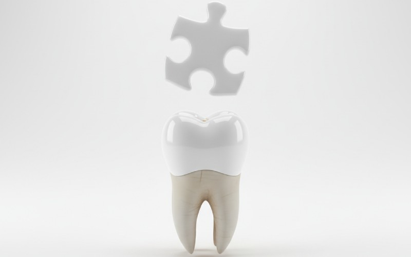 Ceramic restoration fitting into tooth